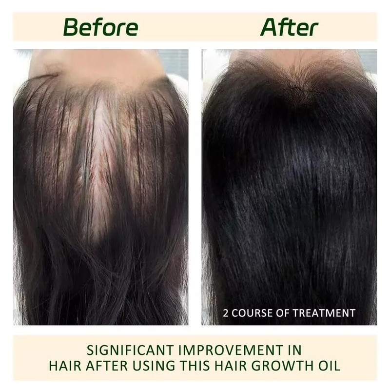 Batana Oil for Hair Growth, with Rosemary Oil For Promotes Hair Thickness, Nouri gallery