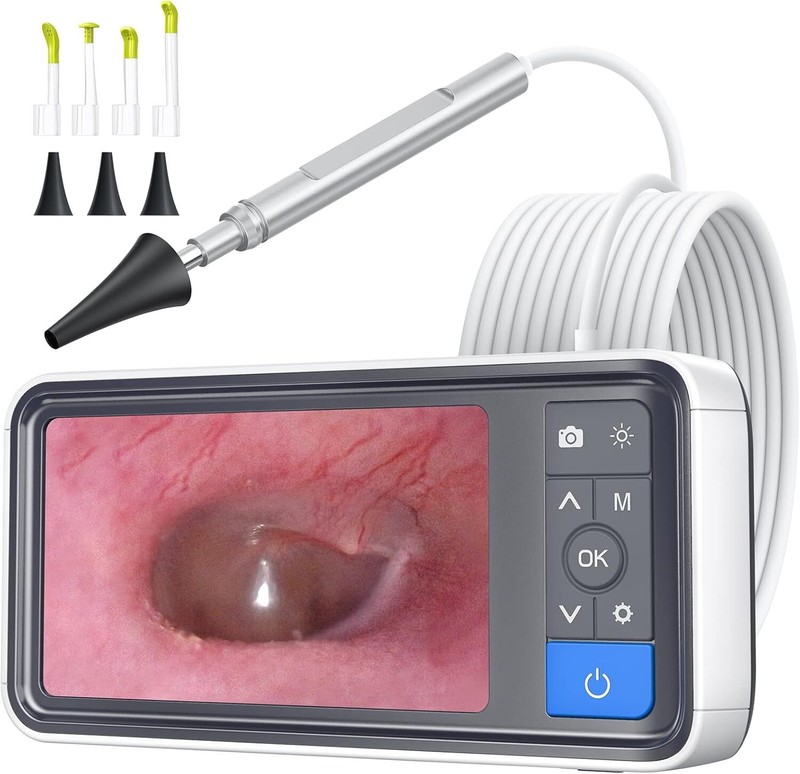 3.9mm Otoscope Camera 1920×1080 Smart Visual Ear Wax Removal 4.5″ IPS Screen