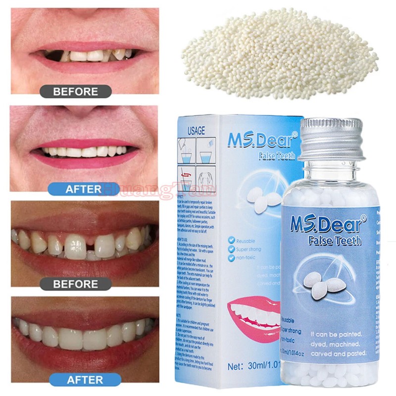 Strong Teeth Tooth Repair Permanent Dental Cement Cavity Filling Kit Fake Teeth gallery
