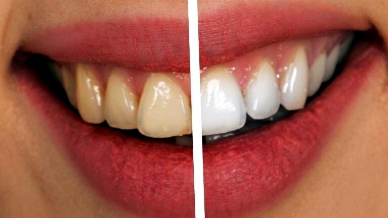 6~FLUORIDE FREE MINT TOOTHPASTE Natural Bamboo Activ Charcoal Teeth Whitening gallery