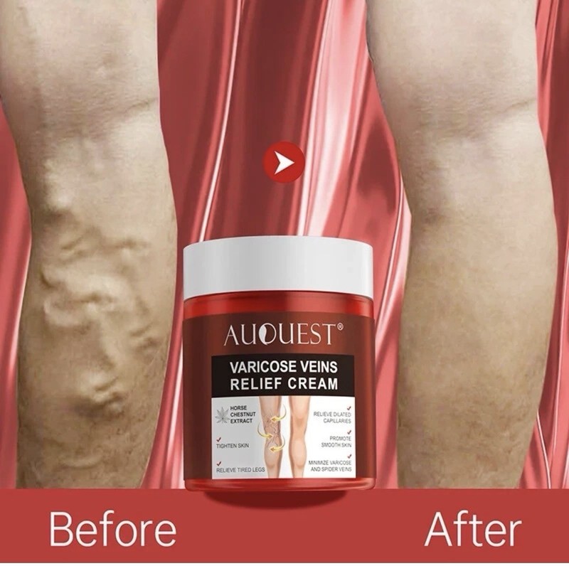 Varicose Veins Relief Cream Relieve Tired Legs Spider Pain Tighten Smooth Skin
