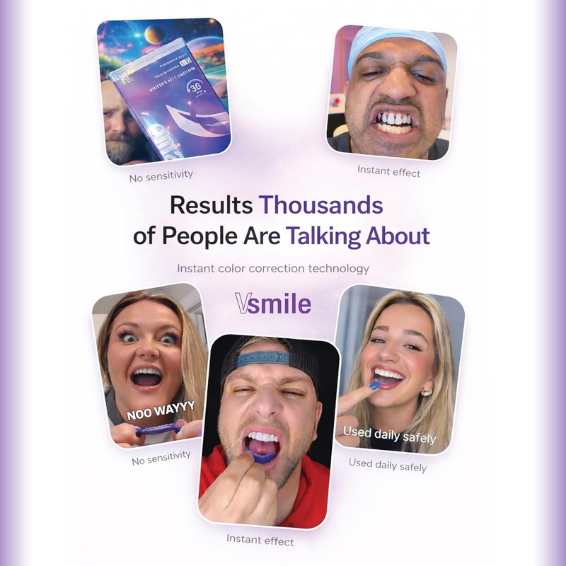 VSmile V38 Teeth Whitening Strips, 28 Count – Peroxide-Free Purple Color gallery