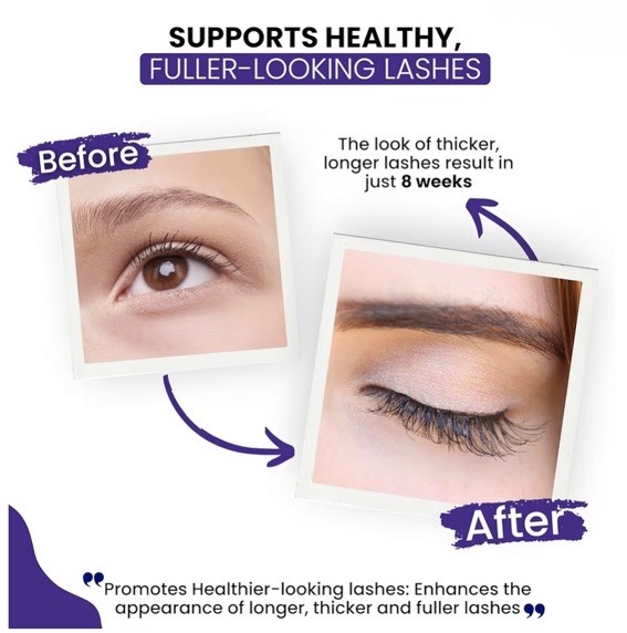 RapidIash Eyelash Enhancing Serum (0.1oz) – Brand New in Box gallery
