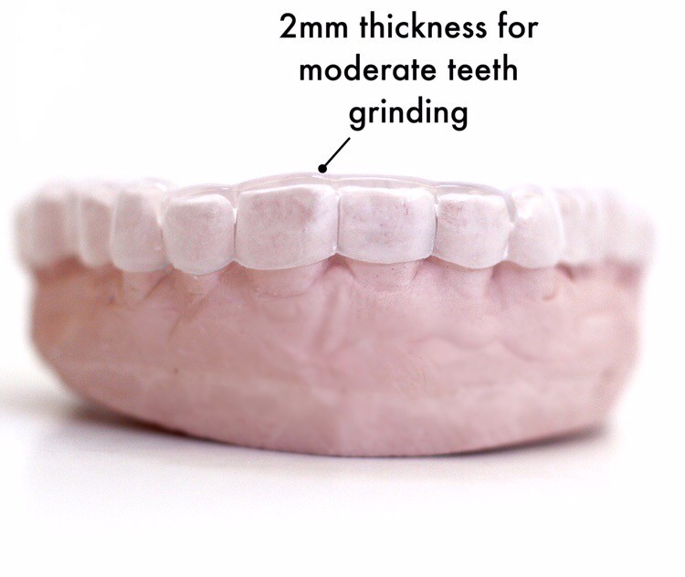 Dental Night Guard ~ Custom Fitted Teeth Grinding Direct from USA Dental Lab gallery