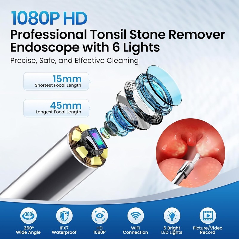 Tonsil Stone Remover with Camera 1080P Visual Tonsil Stone Removal Kit gallery