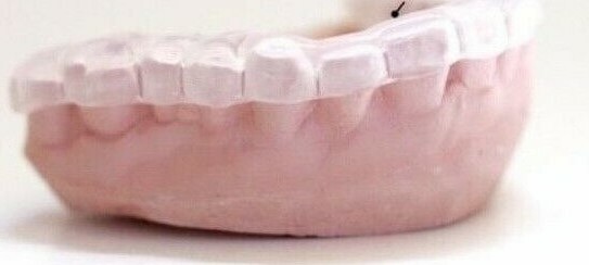 Dental Night Guard ~ Custom Fitted Teeth Grinding Direct from USA Dental Lab gallery