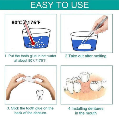 Dental Temporary Crown Veneers for Anterior Front Teeth Whitening 70Pcs gallery