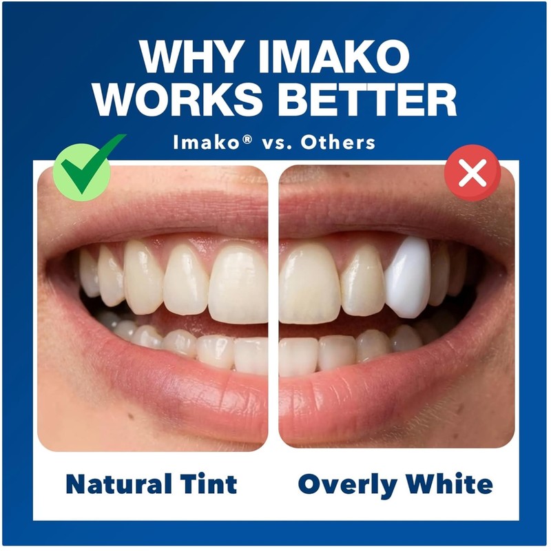 Temporary Tooth Replacement – Tooth-Colored Moldable