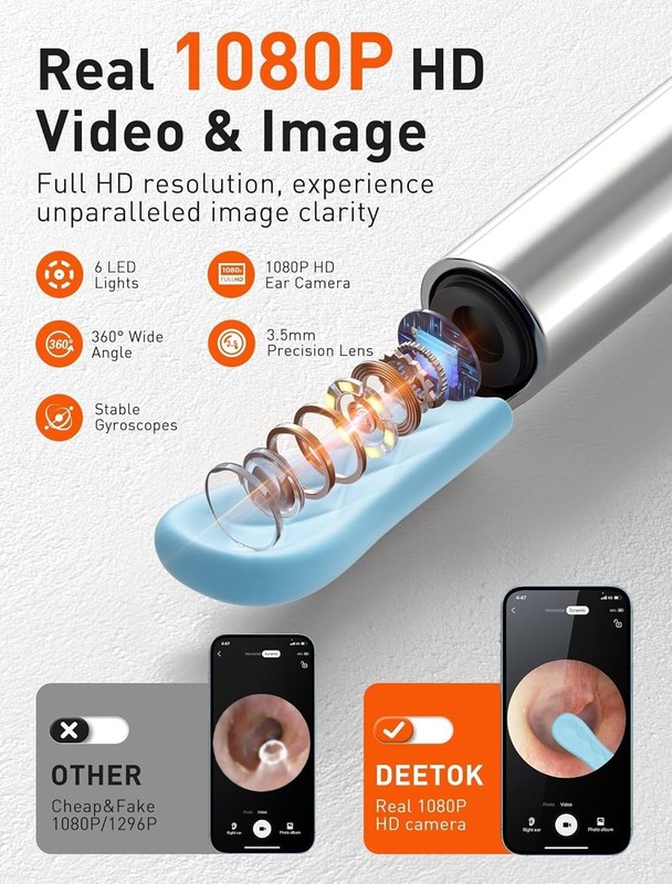 Professional Otoscope with Light & 1080P Camera - Ear Wax Removal Kit Included gallery