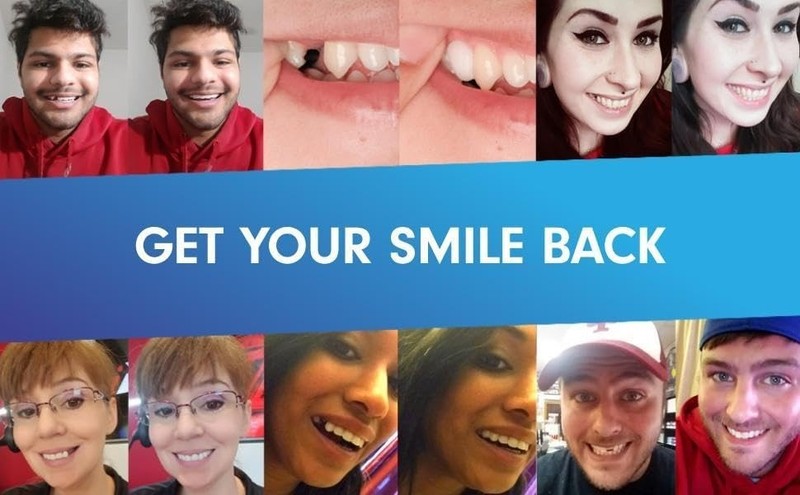 Moldable Tooth Beads: Trusted Temporary Solution for Gaps & Missing Teeth gallery