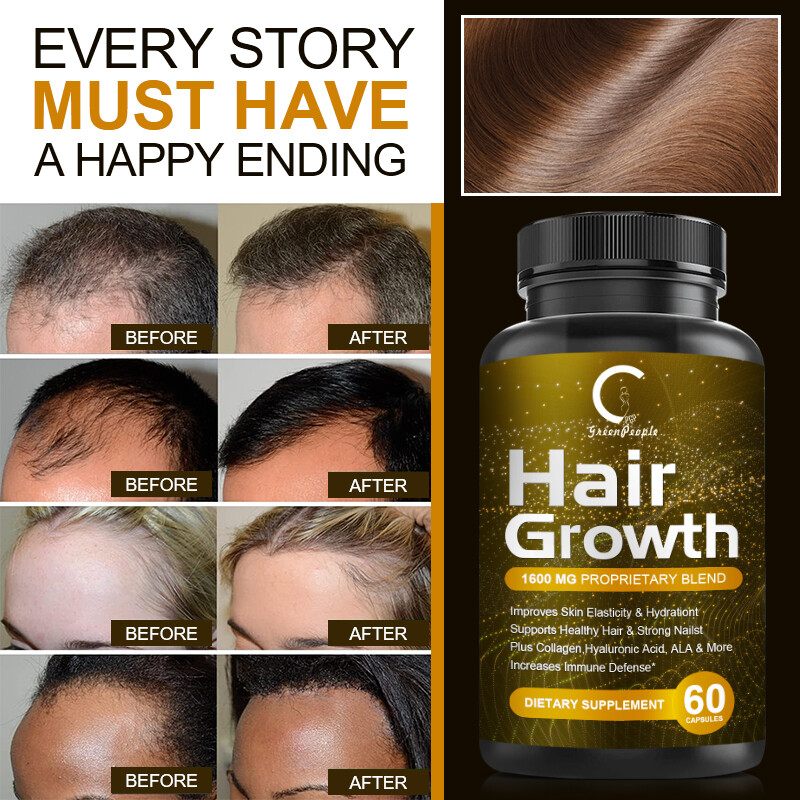GPGP Hair Growth Vitamins For Adults, Prevent Hair Loss, Promote Grow Hair