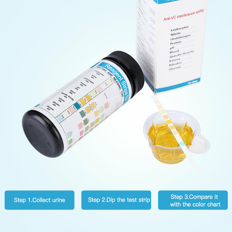 100PCS/1Box Urs-10T Urine Dipstick 10 Parameter Test Strips Urinalysis Reagent gallery