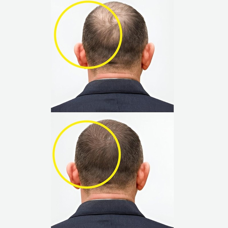 Hair Growth Serum with 3% Redensyl, 5% Capixyl, 4% Anagain, 3% Procapil & 3% Bai gallery