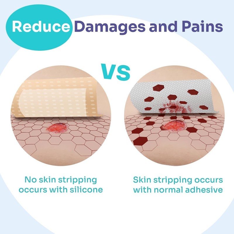 Pack of 5 Silicone Self-Adhesive Dressings 4'' x 4'' for Comfortable Wound Care gallery
