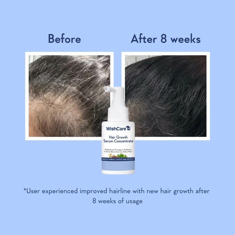 WishCare Hair Growth Serum 30ml Redensyl Anagain Biotin Anti Hair Fall gallery