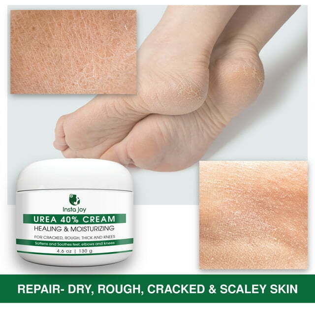 40% Urea Cream For Exfoliate Dry Foot & Hand, Dead Skin Remover, Moisturizer gallery