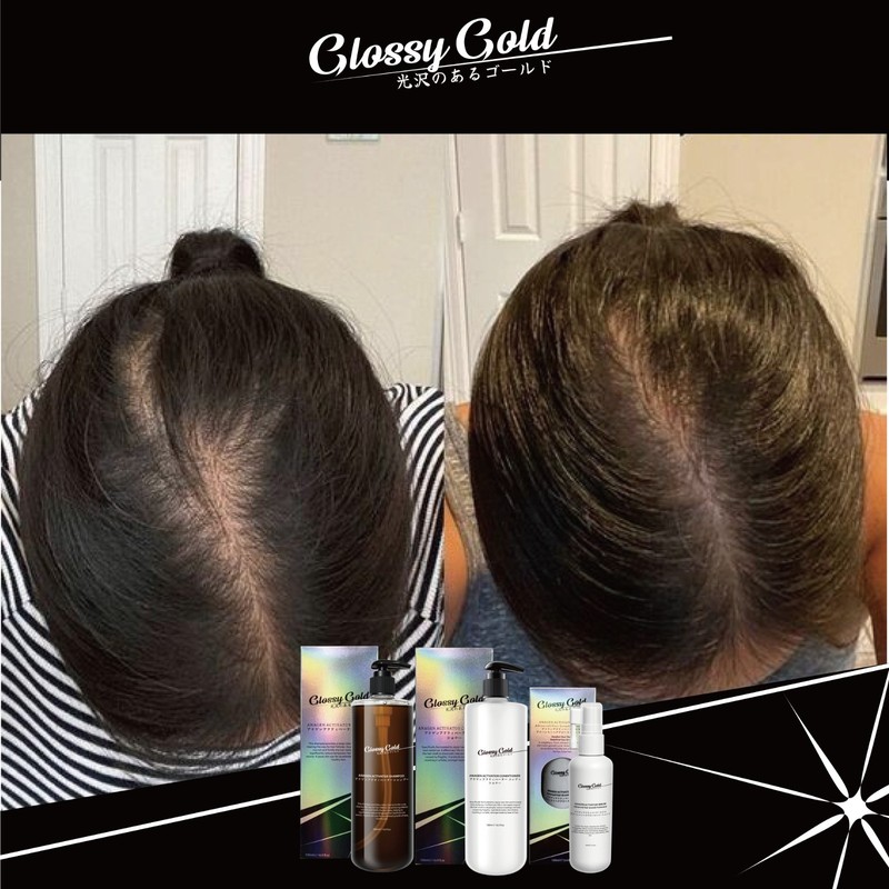 Glossy Gold Anagen Activator Shampoo 500ml gallery
