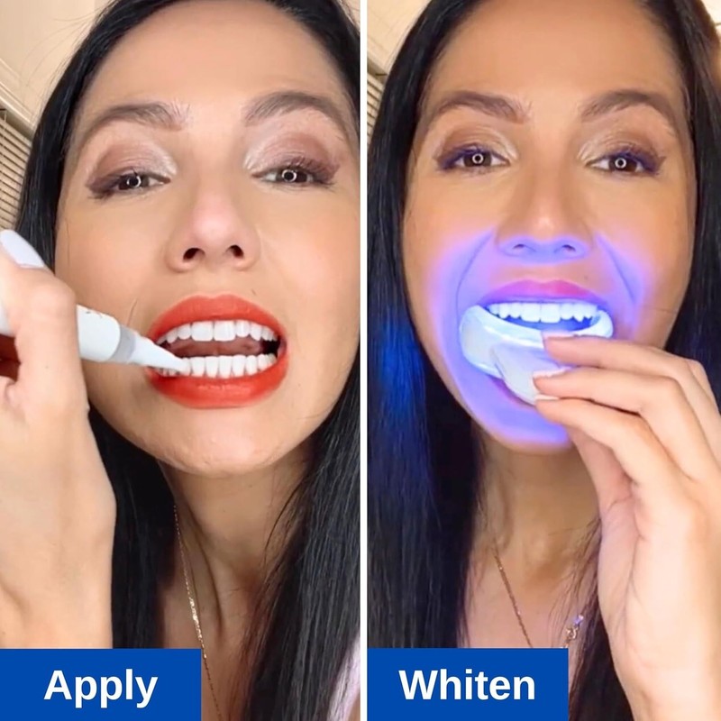 Polar MD Teeth Whitening Kit, Professional Teeth Whitener Gel Pens, 1YR. Supply, gallery