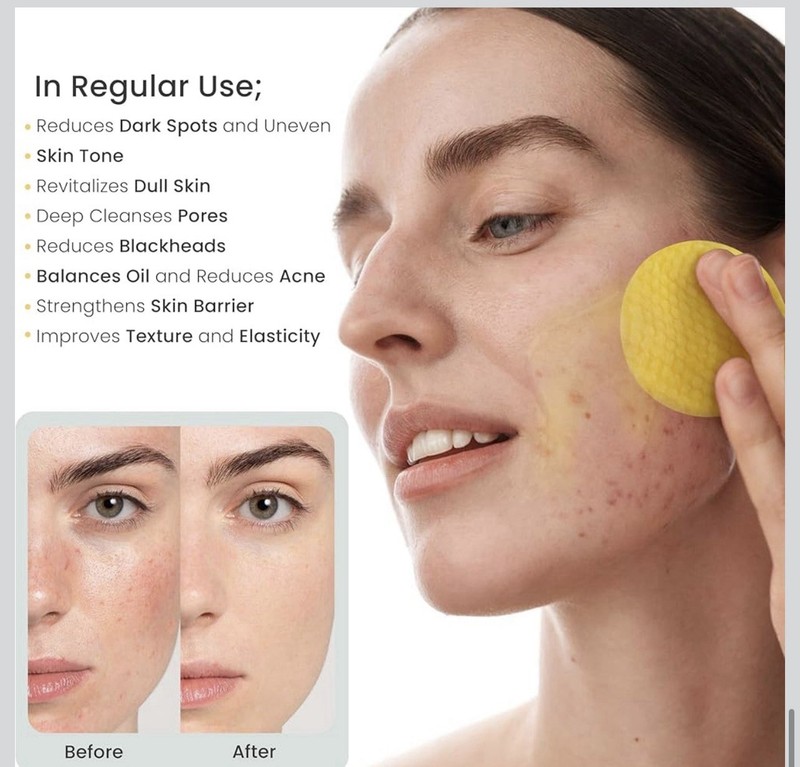 Turmeric Kojic Acid Cleansing Pads, 50 Pcs Exfoliating Cotton Rounds for Face gallery