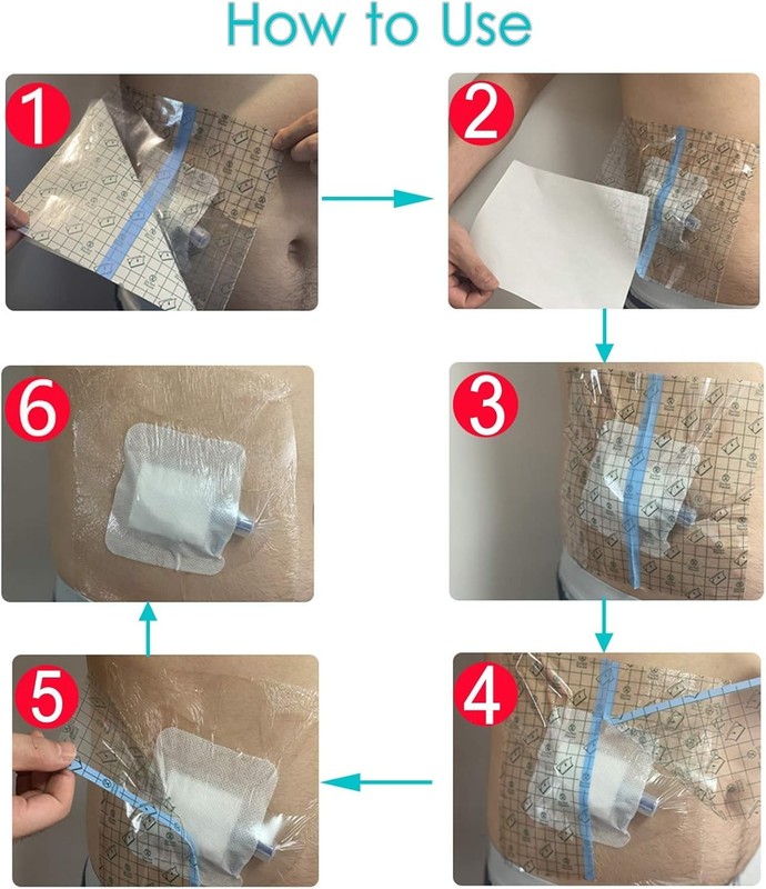 50 Pcs Waterproof Shower Protector Bandage 4x4 inch for Chest Chemo Dialysis Cat gallery