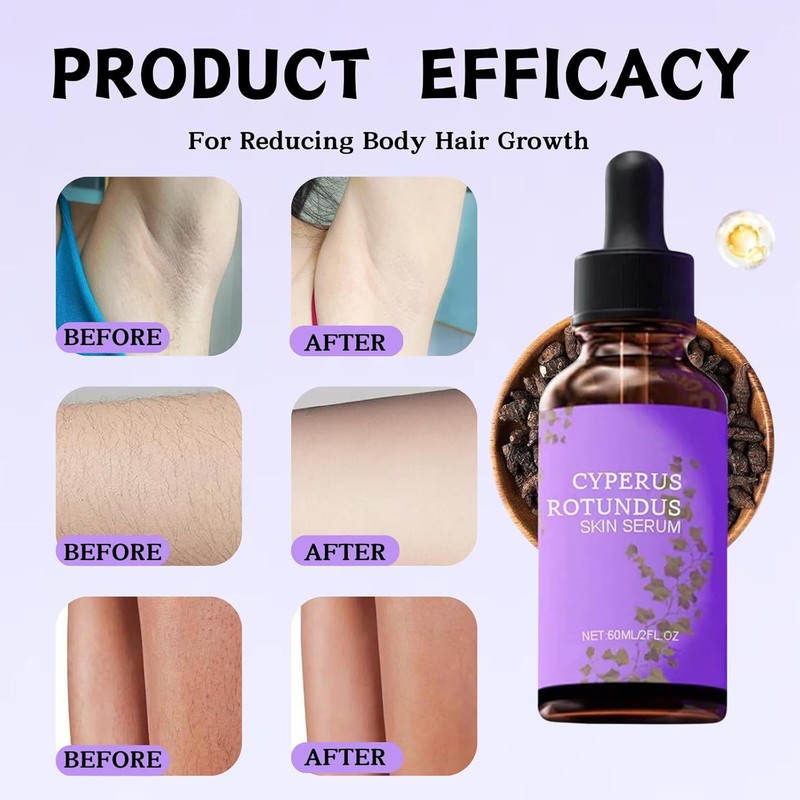 2PCS Cyperus Rotundus Skin Serum, Cyperus Rotundus Oil，Hair Removal Repair Ess gallery