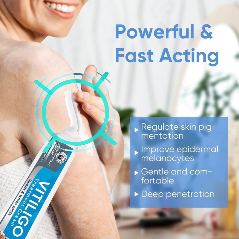 Vitiligo Treatment, Vitiligo Cream Improve Skin Pigmentation & Reduces White ... gallery