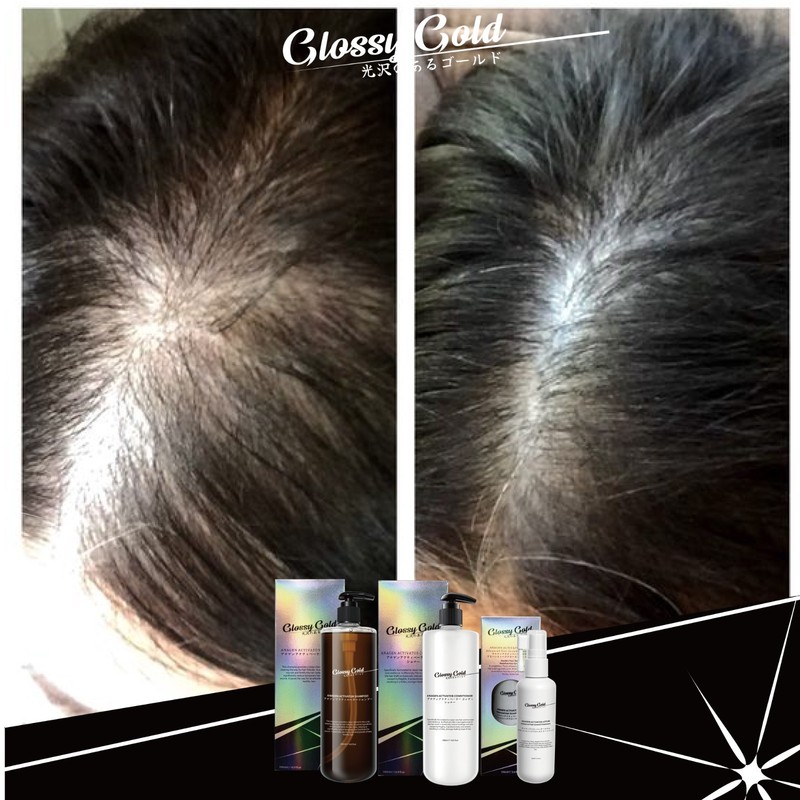Glossy Gold Anagen Activator Shampoo 500ml gallery