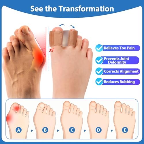 Bunion Toe Separators for Overlapping Toes, 3-Point Support Gel Toe L 2 Pack gallery