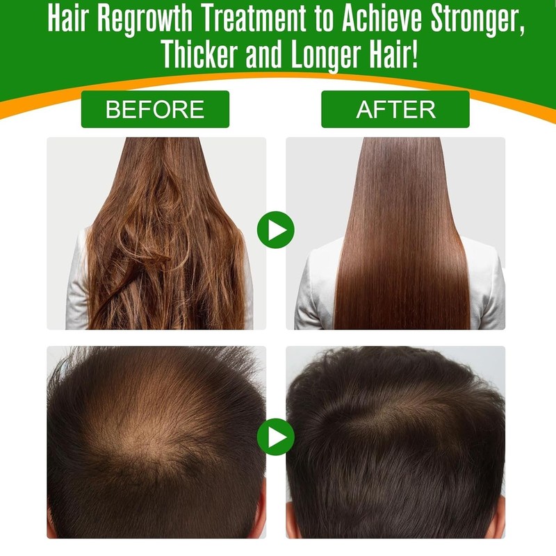 Batana Oil Hair Growth Treatment Organic Natural Scalp Care Men Women 60ml gallery