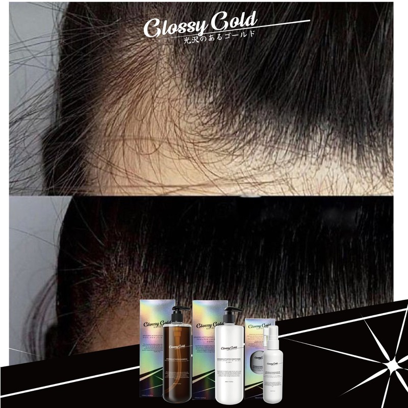 Glossy Gold Anagen Activator Shampoo 500ml gallery