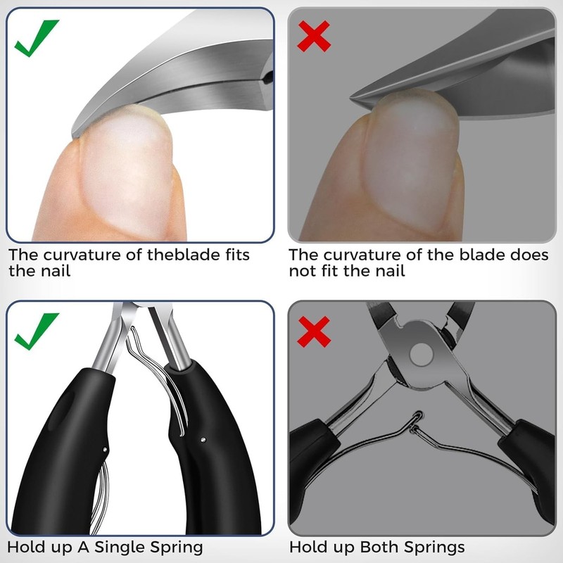 Ingrown Toenail Removal Kit, 5PCS Stainless Steel Toe Nail Kit, Straight Edge... gallery