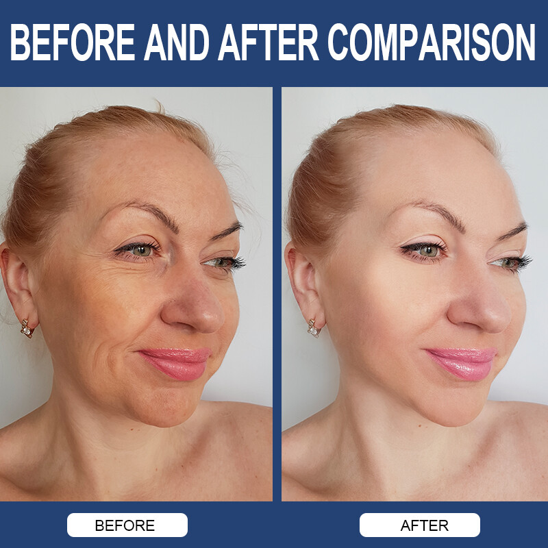 Umary Alternative Hyaluronic Acid 850mg Capsules Vitamin C Joint and Skin Health gallery