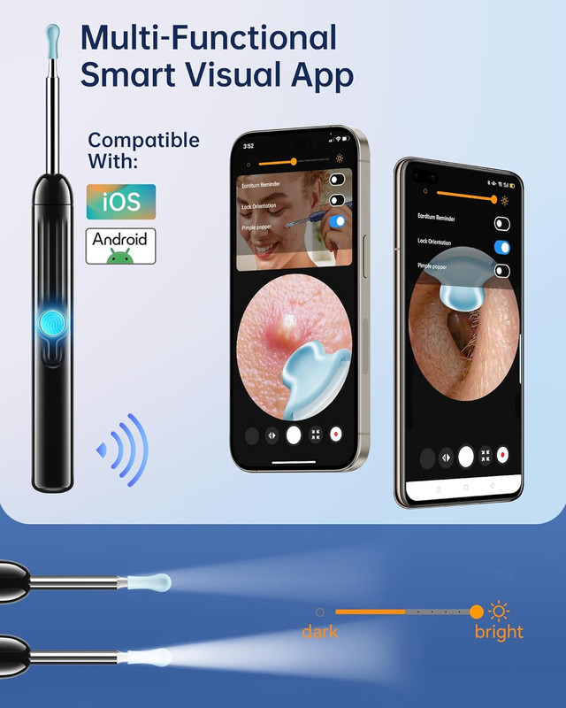 Jegoat Ear Wax Removal, 1080P HD Scope and 6 LED Lights, Ear Cleaner with Camera gallery