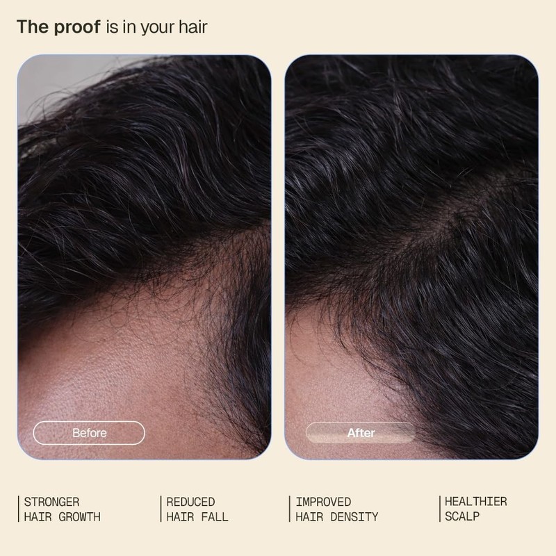 Hair Growth Serum (30ml) with 3% Redensyl, 3% Procapil, 5% Kopexil & Rice water. gallery