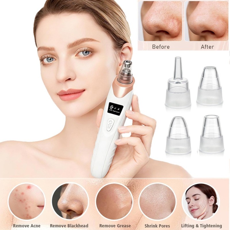Electric Blackhead Remover Pore Nose Sucker Pimple Skin Acne Face Cleaner Vacuum gallery