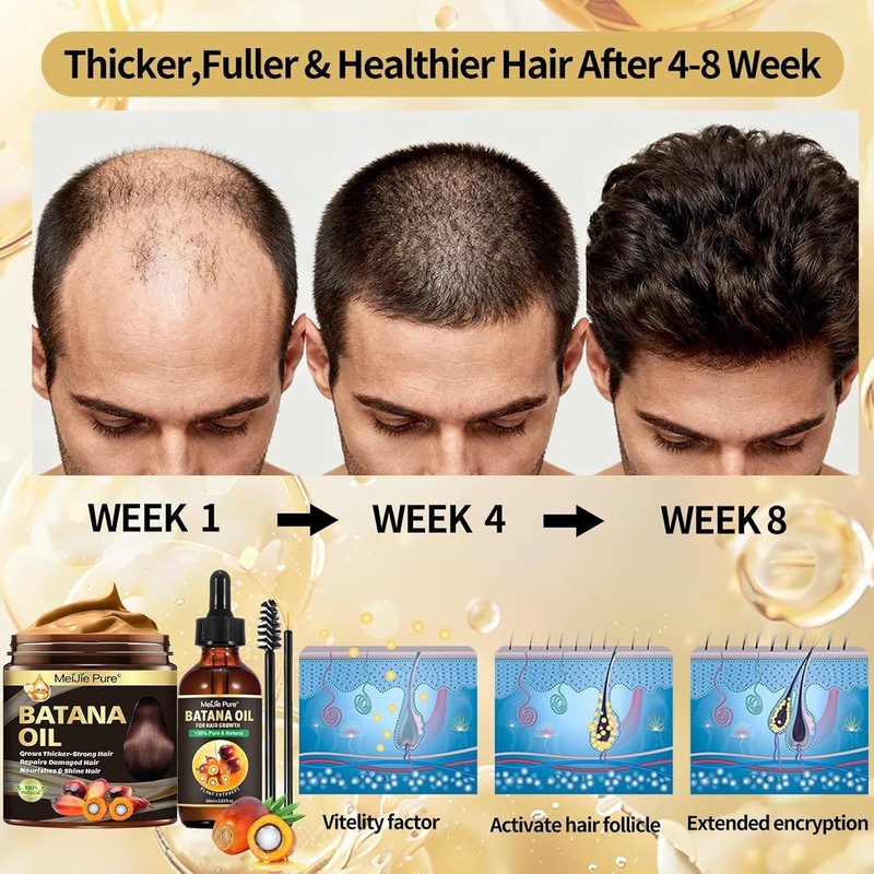 100% Raw Batana Oil for Hair Growth Thick Fuller Hair Scalp Treatment gallery