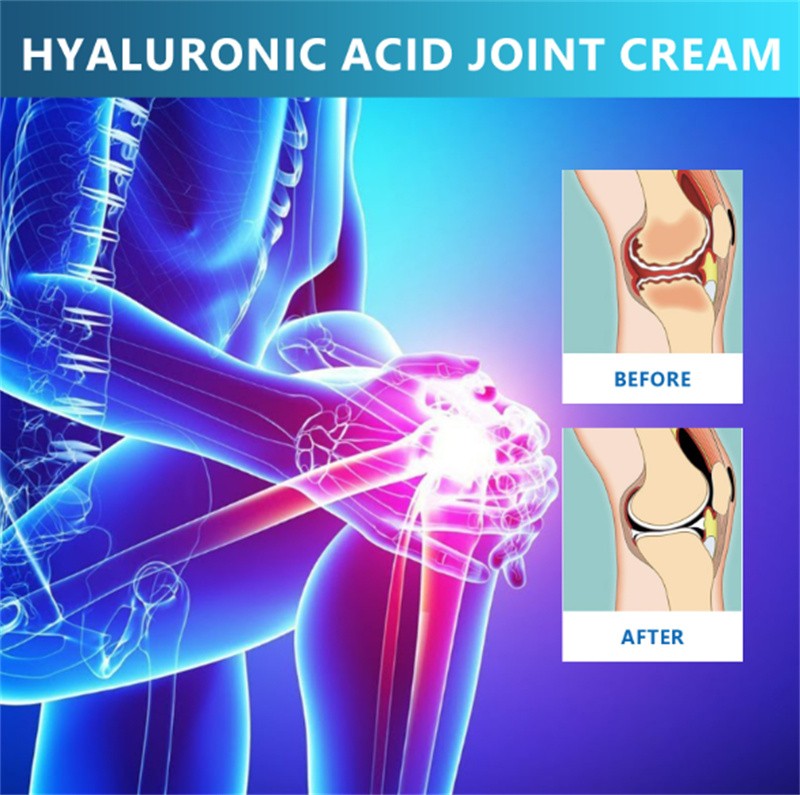 5X Hyaluronic Acid Joint Cream - Joint- Knee Pain Relief 1.76oz - Fast Shipping gallery