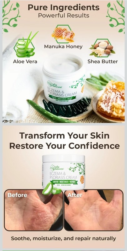 Wild Naturals Eczema & Psoriasis Cream Steroid-Free, Non-Greasy 4 oz Face/Body gallery