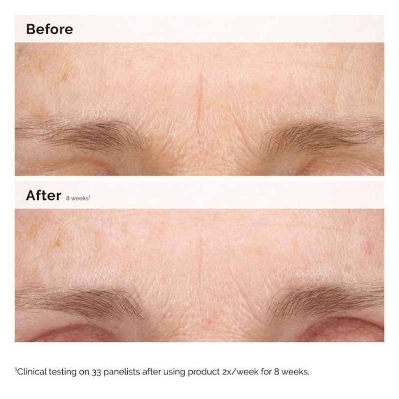 The Ordinary Authentic Retinal 0.2% Emulsion High-Strength Retinoid 0.5 oz gallery