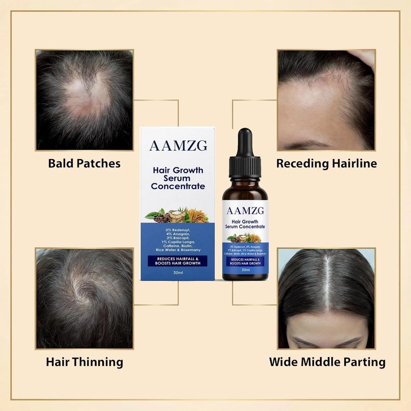 Hair Growth Serum for Women and Men - 4% Anagain,3% Redensyl,2% Baicapil - 30ml gallery