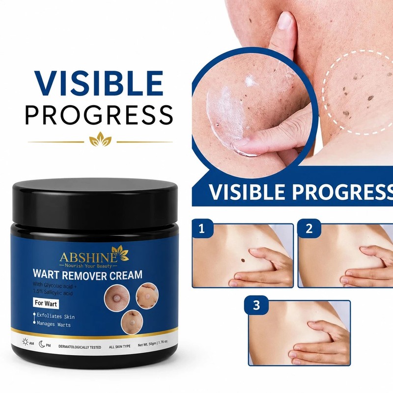 Abshine Genital Wart Removal Cream for Men & Women 50g – FREE SHIP