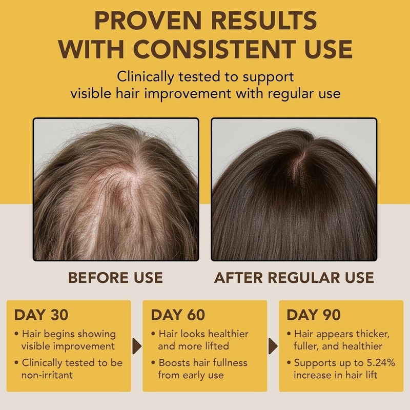 Batana Oil for Hair Growth & Hair Treatment Oils 4 Fl Oz | Dr Sebi Inspired, ... gallery
