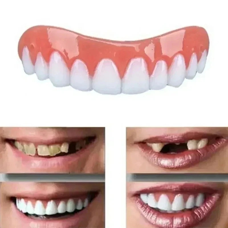 Smile Snap On False Teeth Upper Lower Dental Veneers Denture Tooth Cover Set gallery