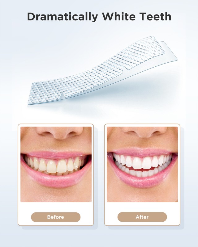 Fairywill 28PCS Teeth Whitening Strips Tooth Rapid Bleaching Teeth White Strips gallery
