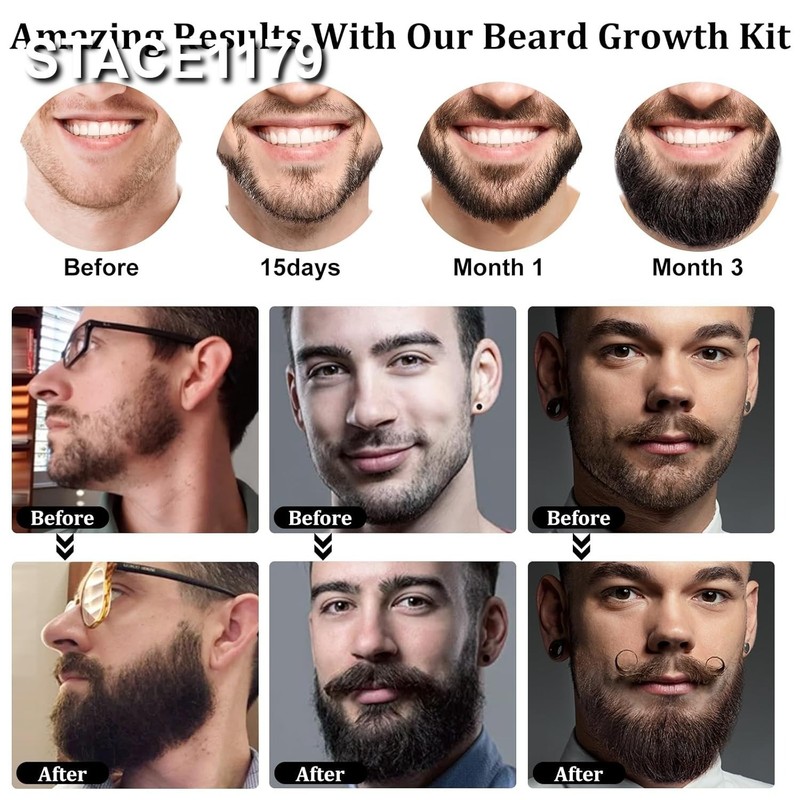 Kit Crecimiento de Barba con Aceite de Biotina y Masajeador Profesional Premium gallery