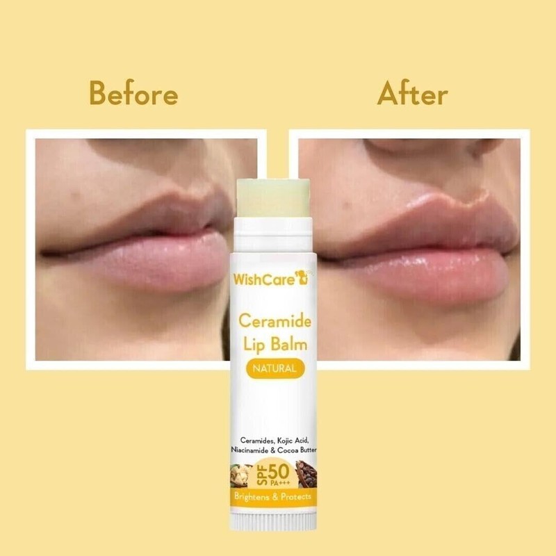 WishCare Ceramide Lip Balm For Lip Lightening & Protection -5gm gallery