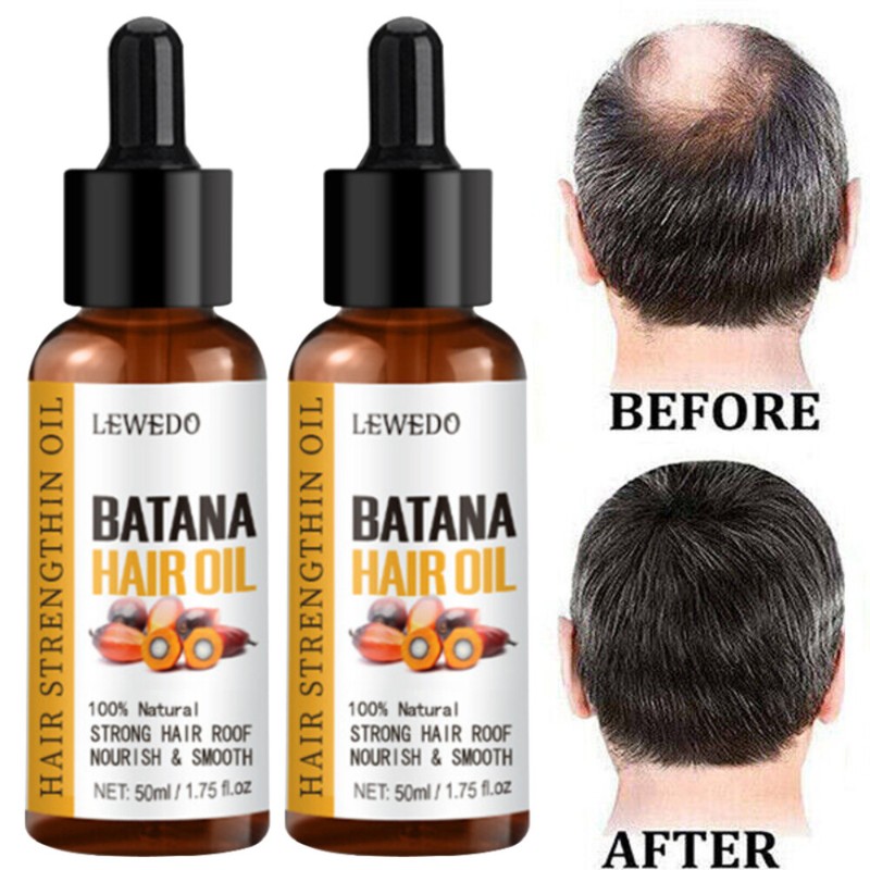 2 X BATANA OIL Serum Natural Hair Growth Promotes Hair Regrowth For Women & Men