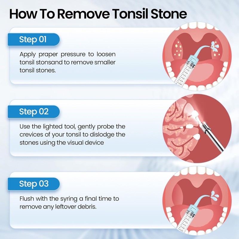 Tonsil Stone Remover with Camera 1080P Visual Tonsil Stone Removal Kit gallery
