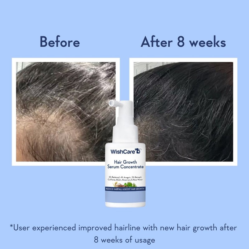 WishCare Hair Growth Serum Concentrate 100ml gallery