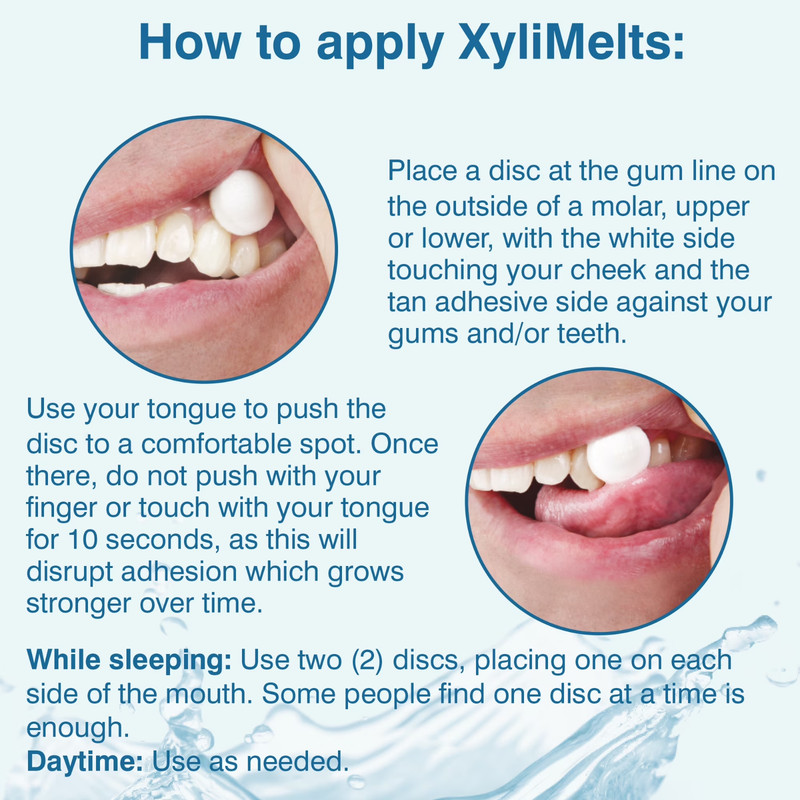 Oracoat Xylimelts for Dry Mouth, Mint Free, 80 Ct Box gallery